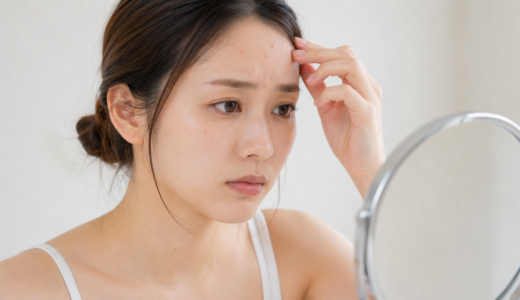 ニキビパッチの効果と使い方を徹底解説｜正しい選び方と注意点