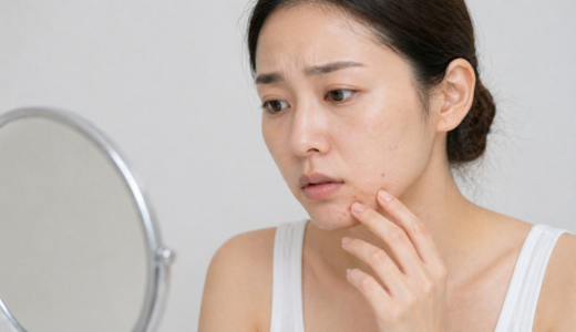 ニキビのかさぶたを正しく理解しよう｜原因・正しいケアと治し方