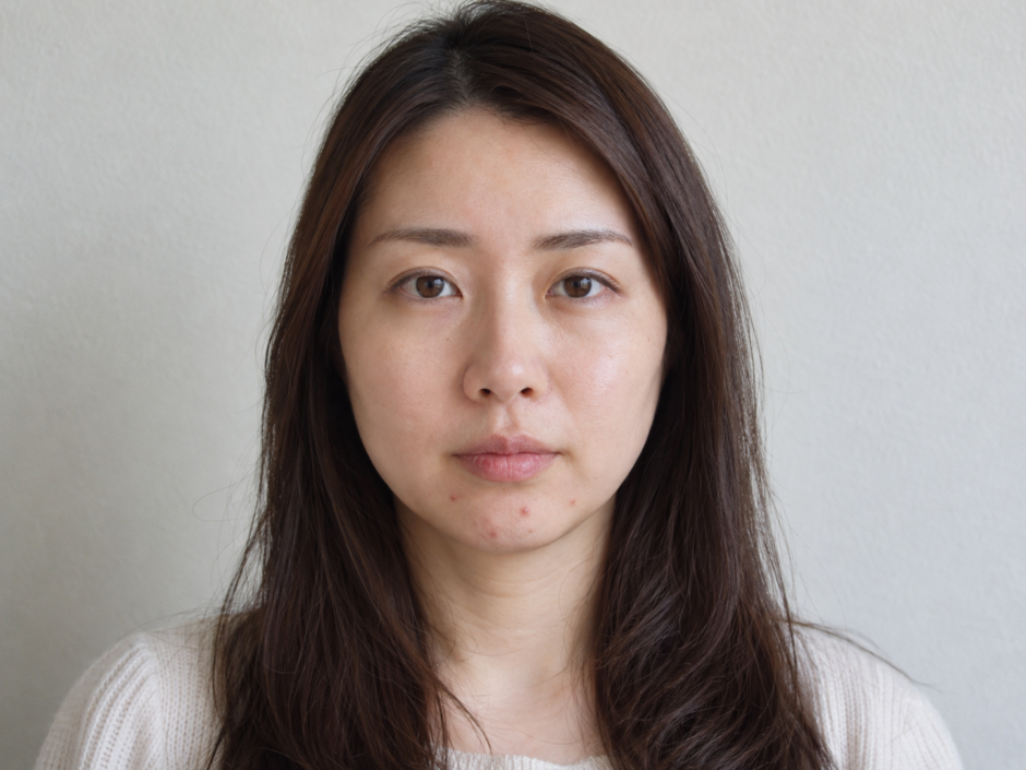 あごにいくつかのニキビがある女性