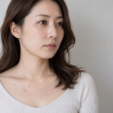 デコルテとおでこにニキビがある女性
