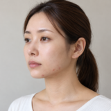 フェイスラインにいくつかニキビがある女性